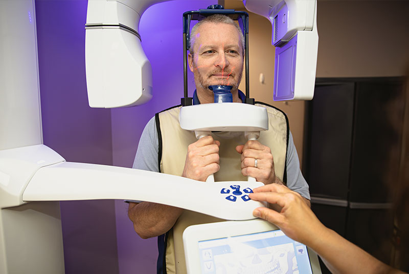 CBCT scan